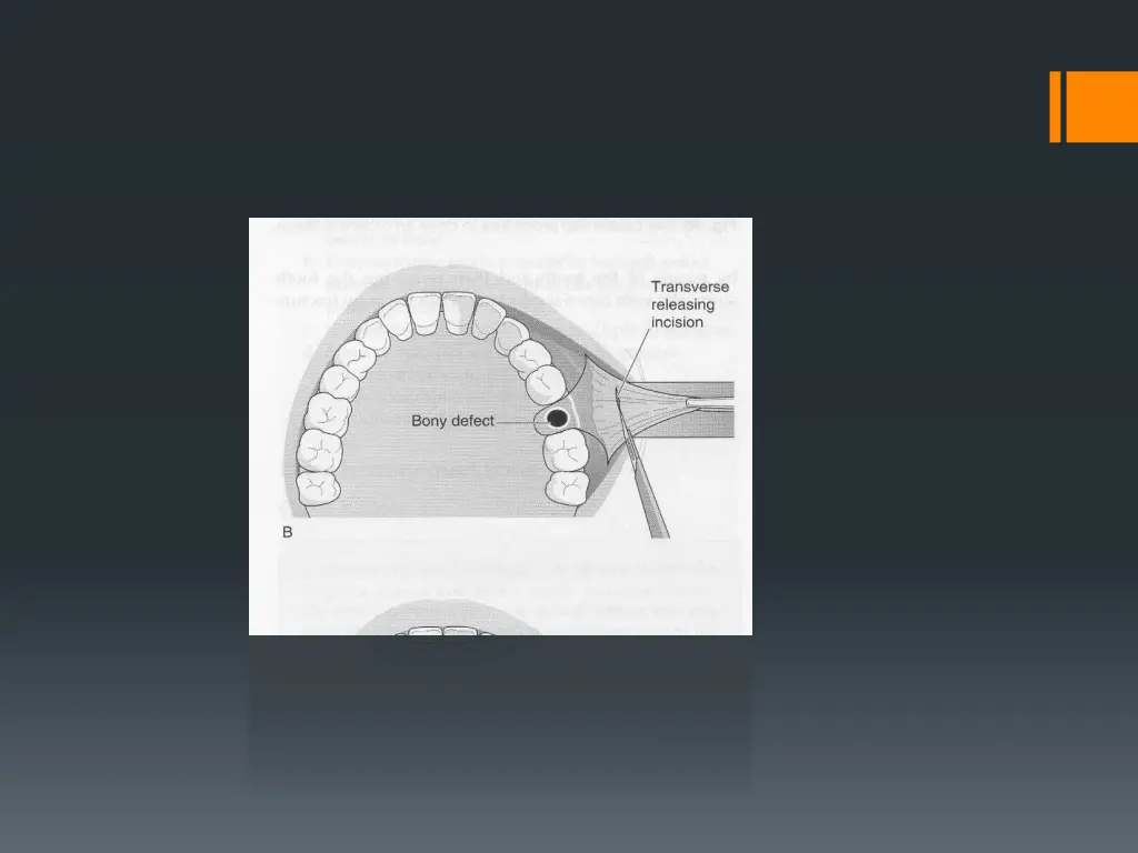 slide27