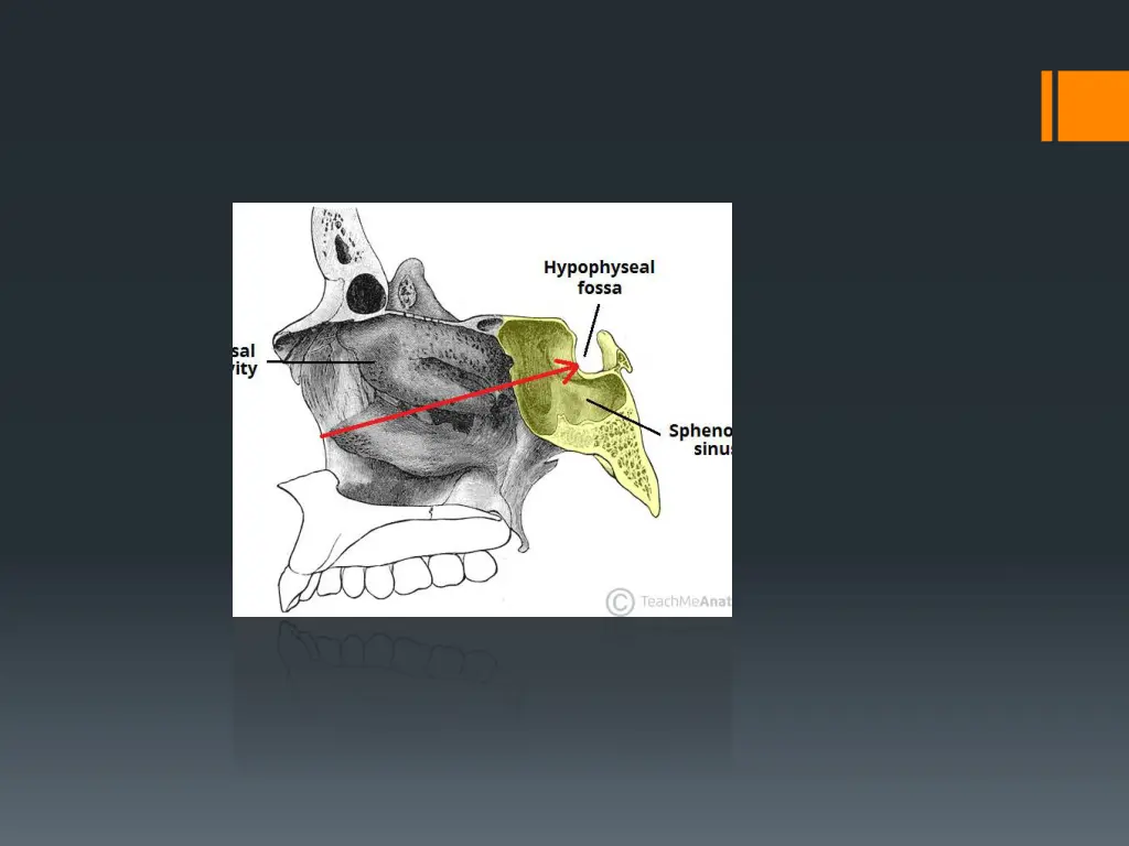slide6