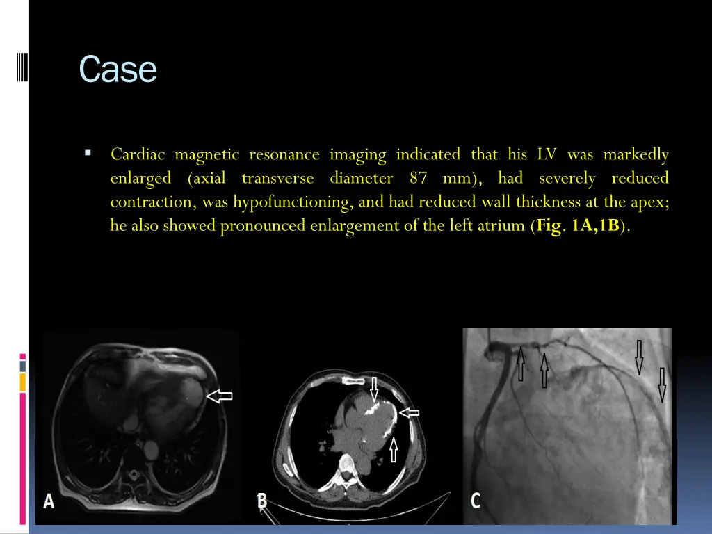 slide5
