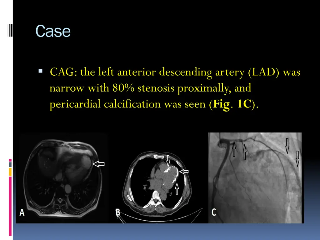slide6
