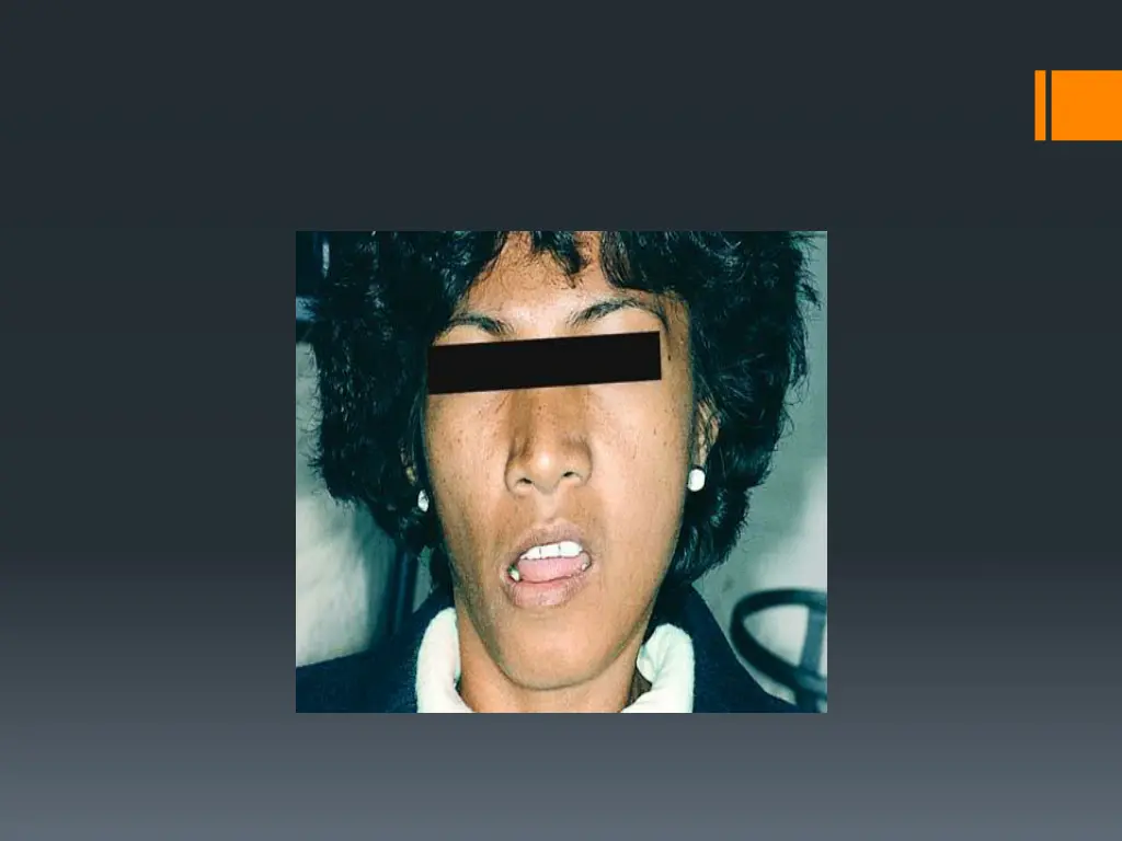 slide13