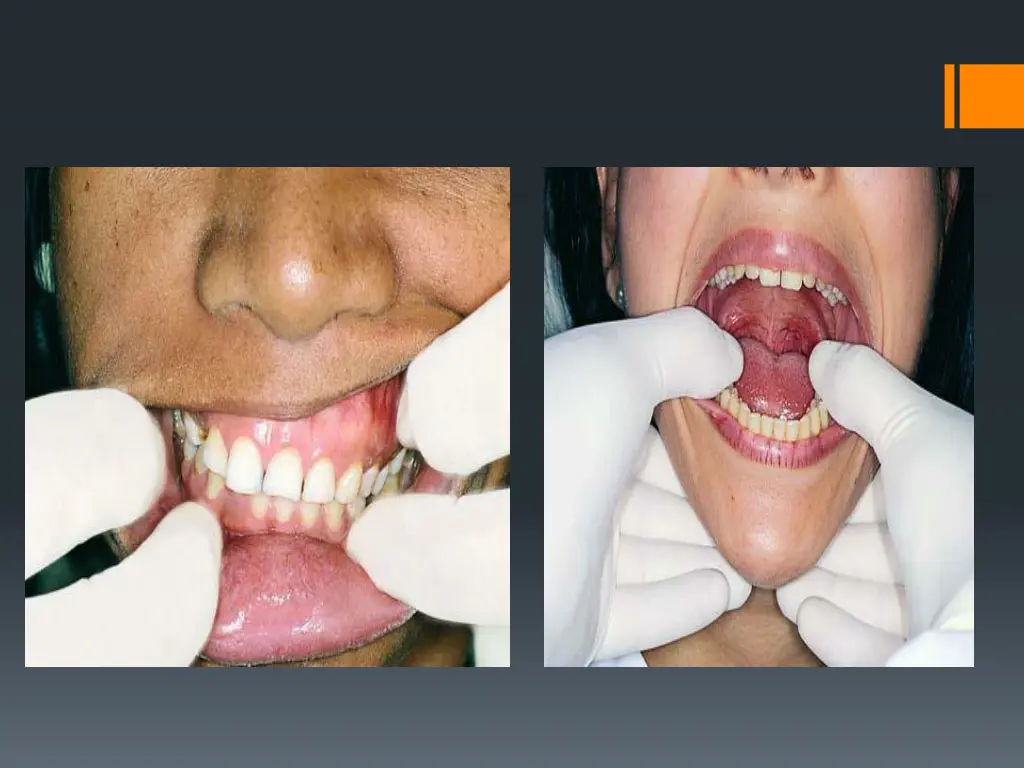 slide14