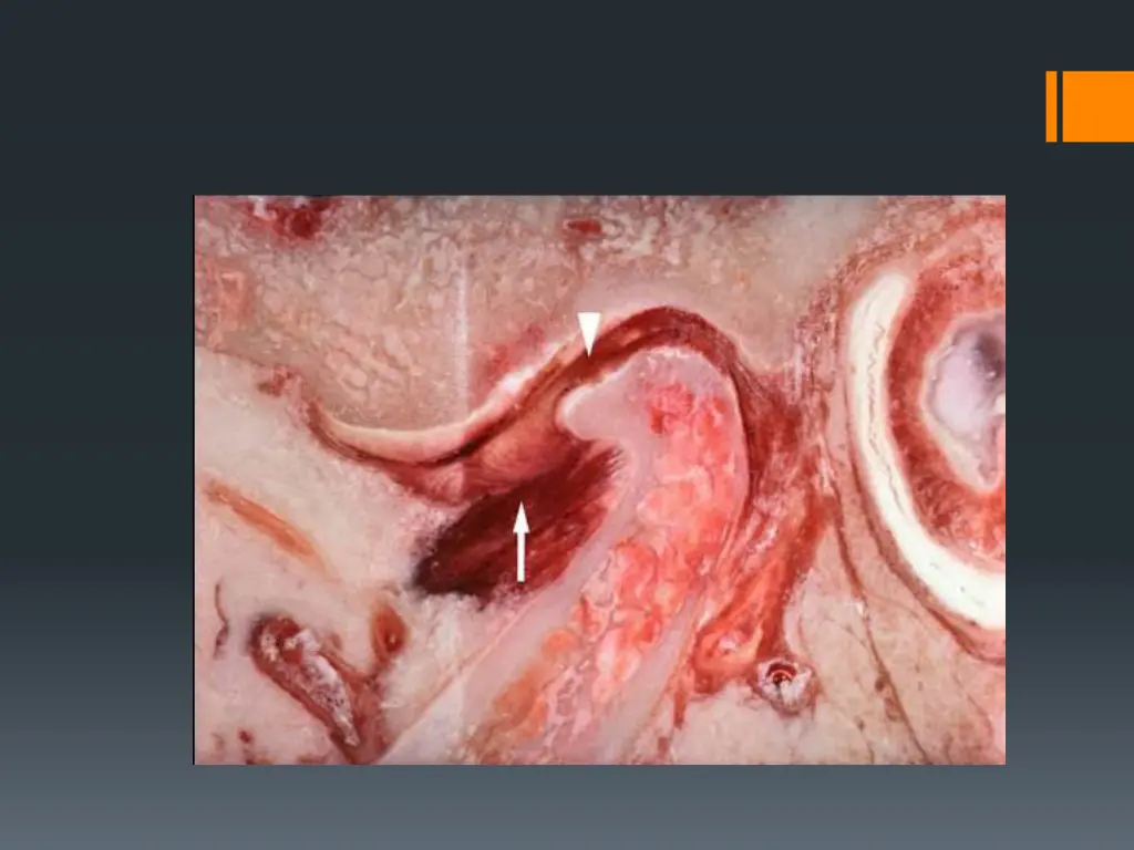 slide27