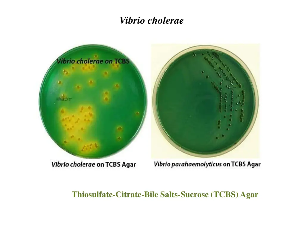 vibrio cholerae 3