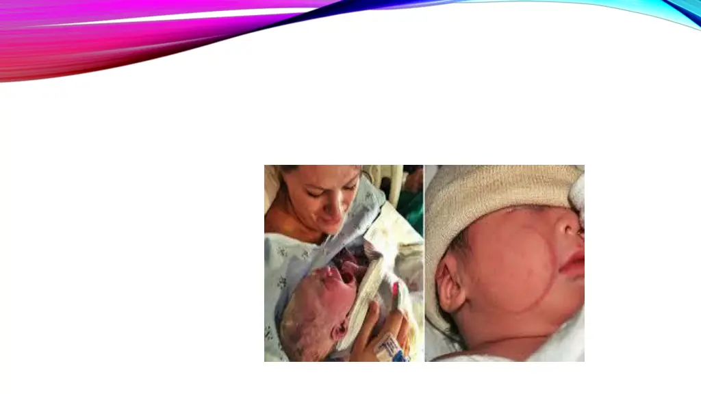 slide10
