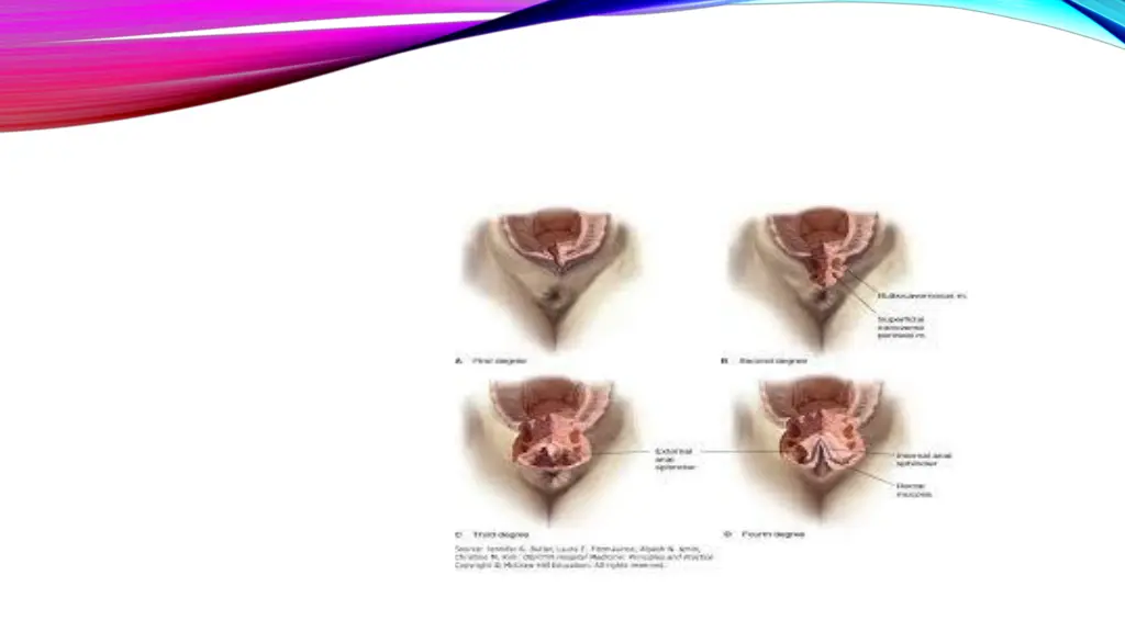 slide12