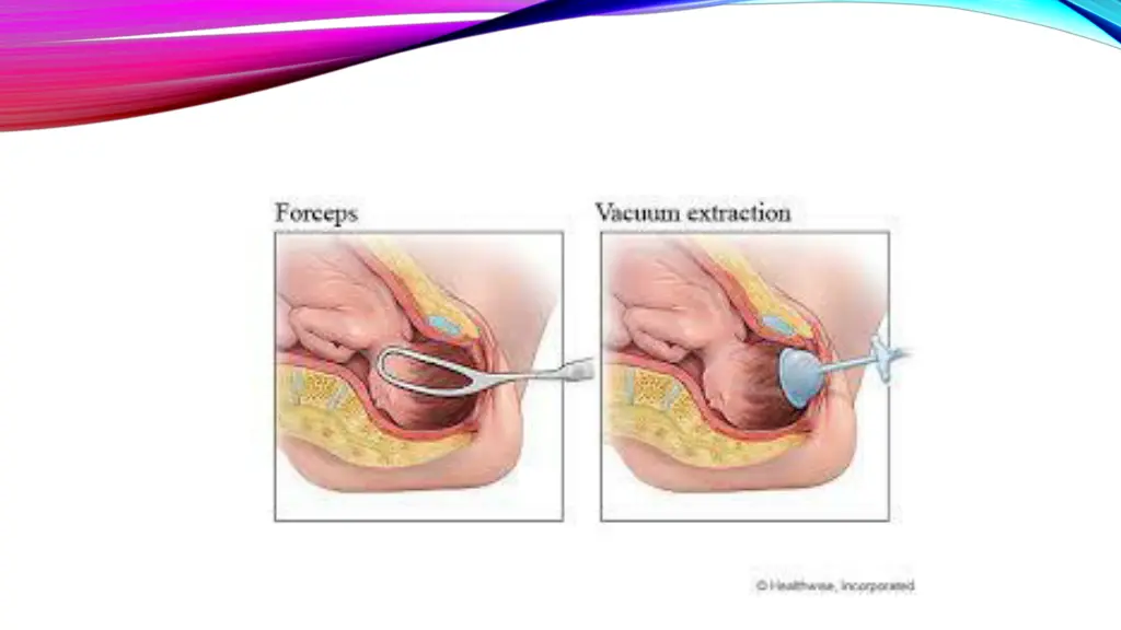 slide6