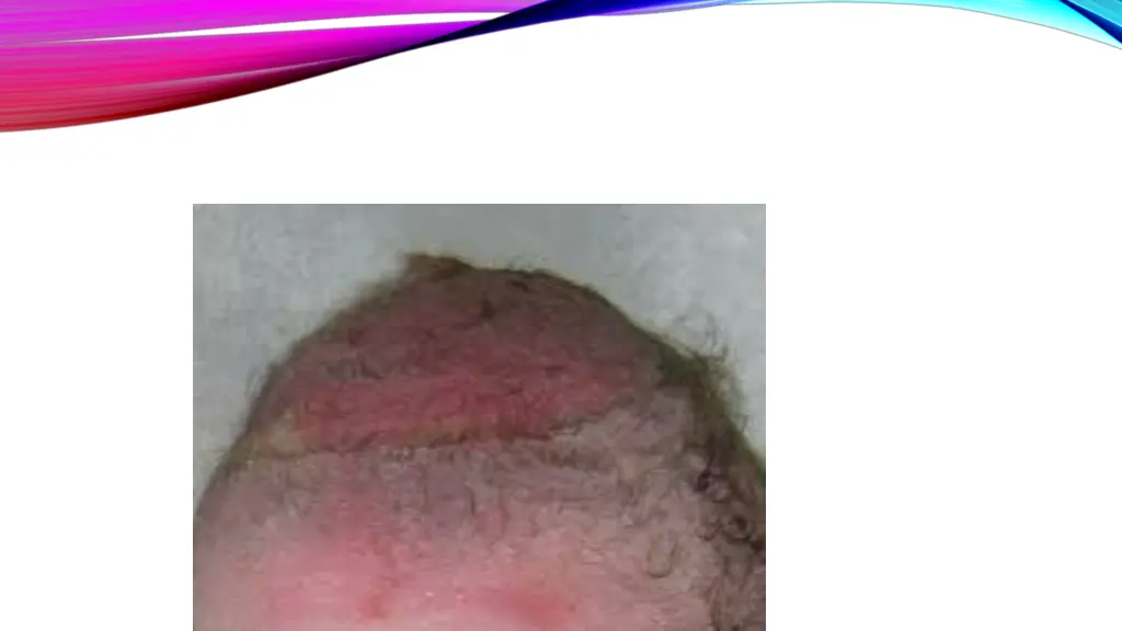 slide9