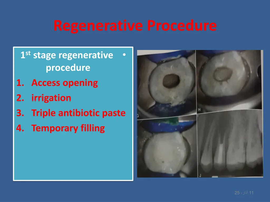 regenerative procedure