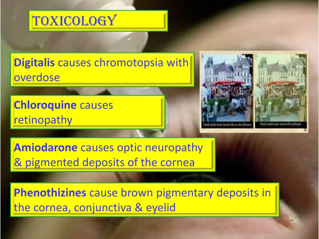 toxicology