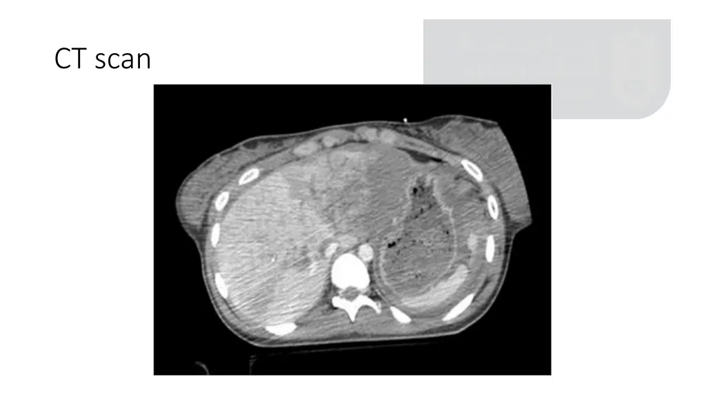 ct scan 1