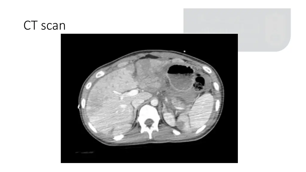 ct scan 3