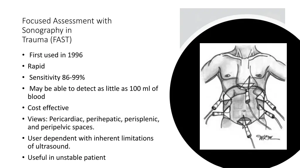 focused assessment with sonography in trauma fast