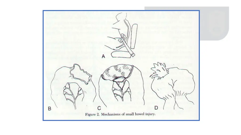 slide22