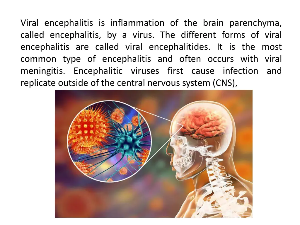 viral encephalitis is inflammation of the brain