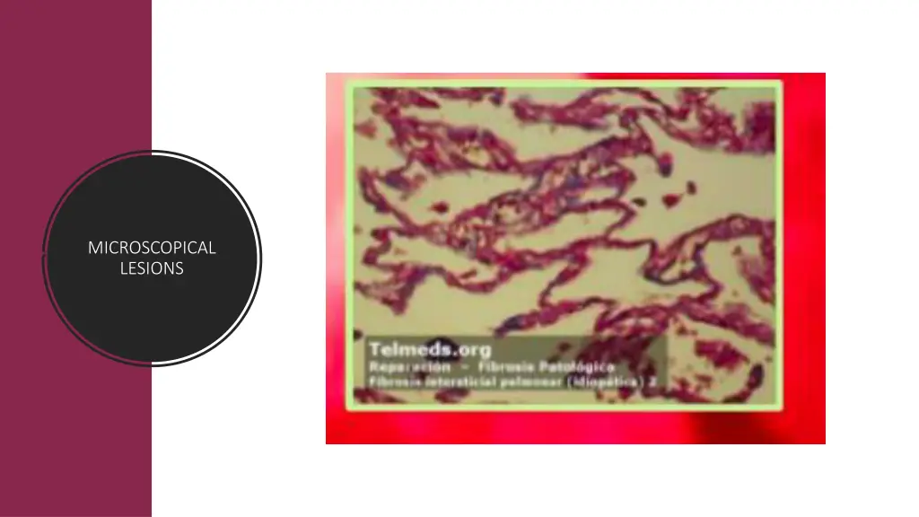 microscopical lesions