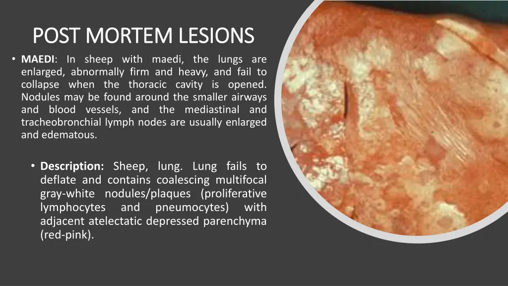 post mortem lesions post mortem lesions maedi