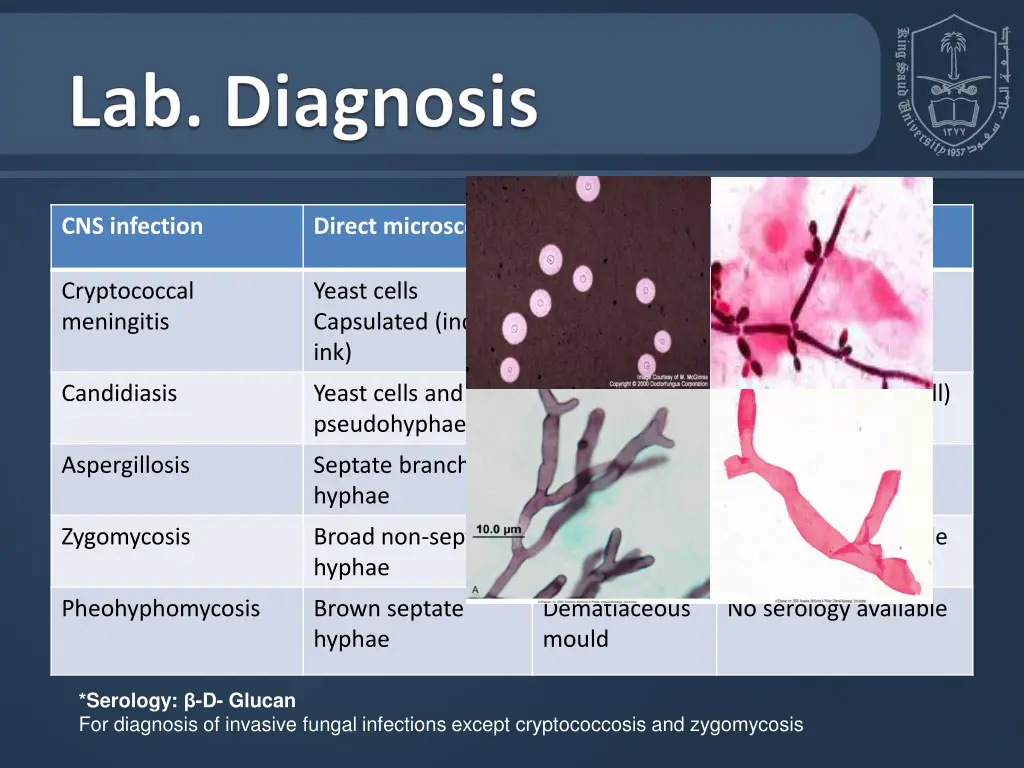 cns infection