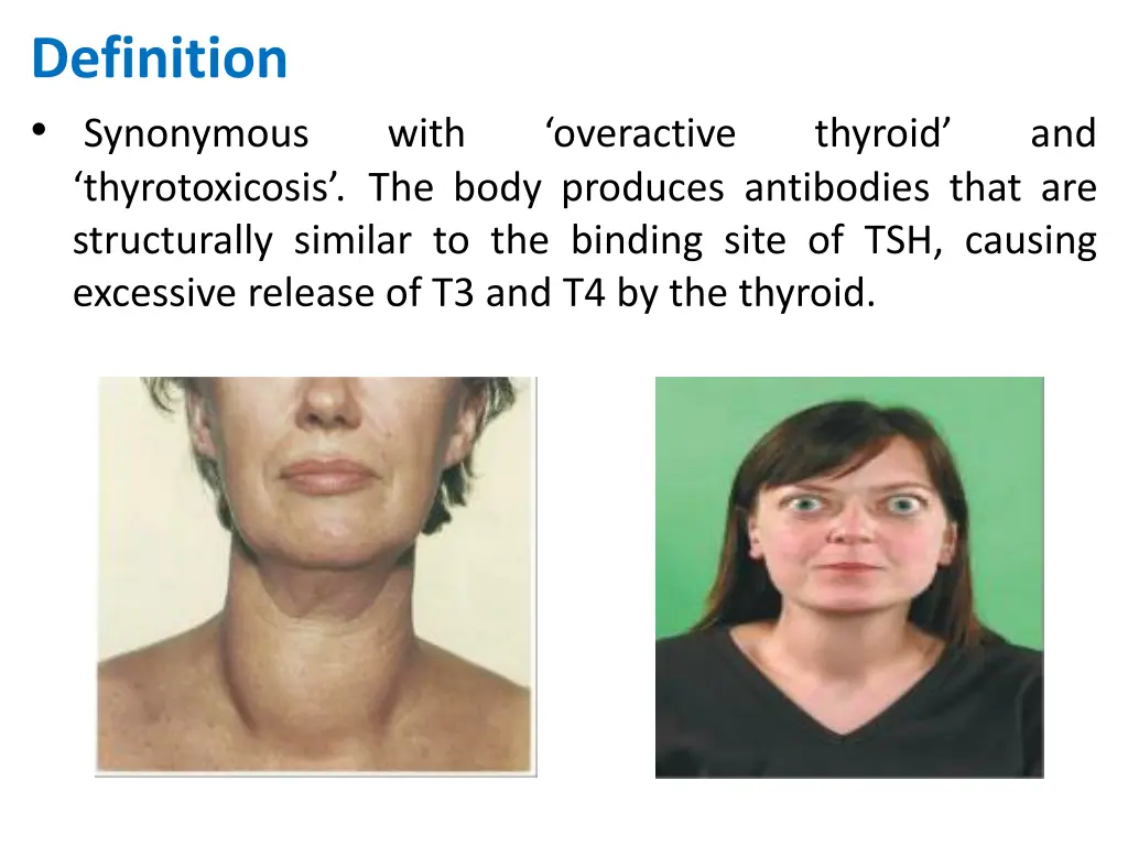 definition synonymous thyrotoxicosis the body