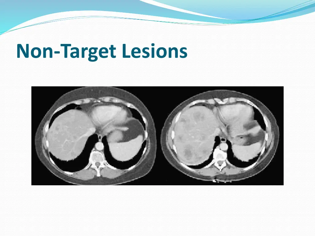 non target lesions 1