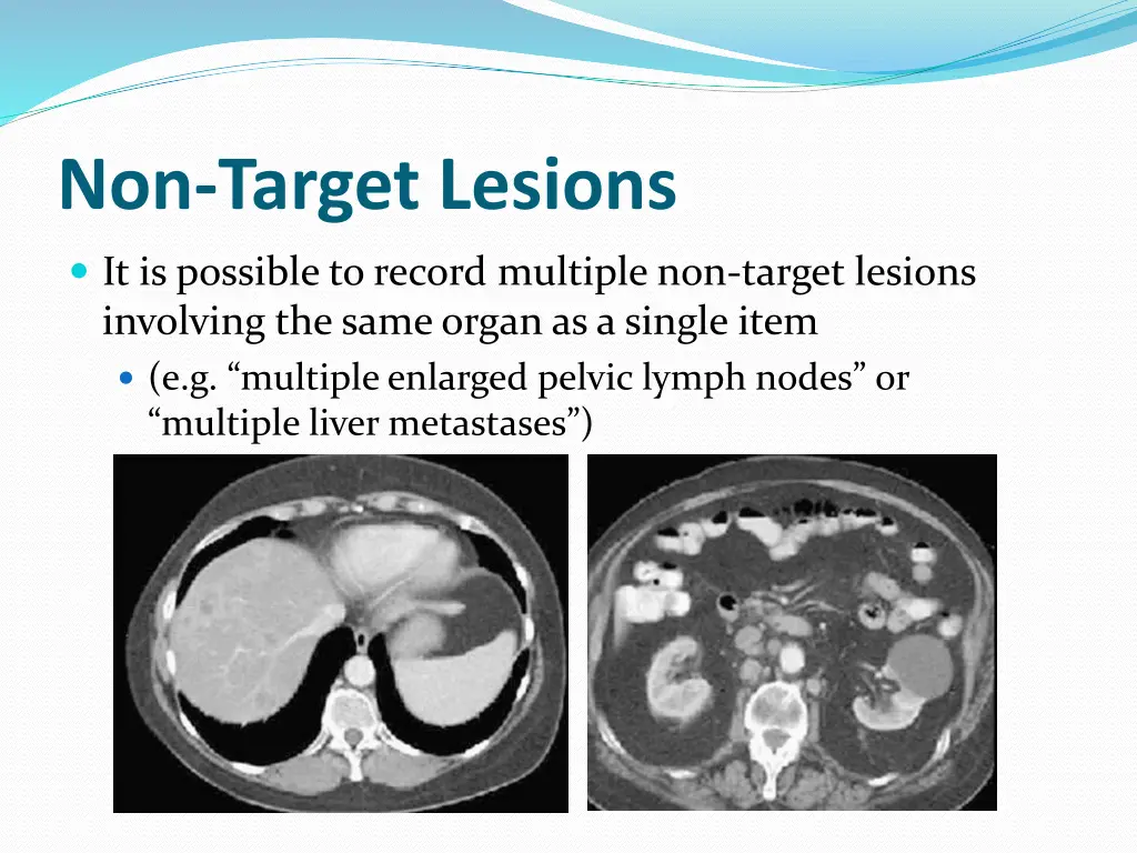 non target lesions