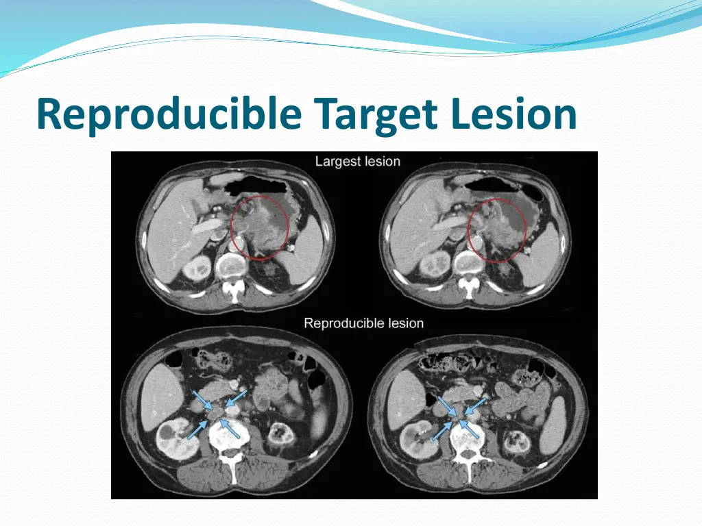 reproducible target lesion