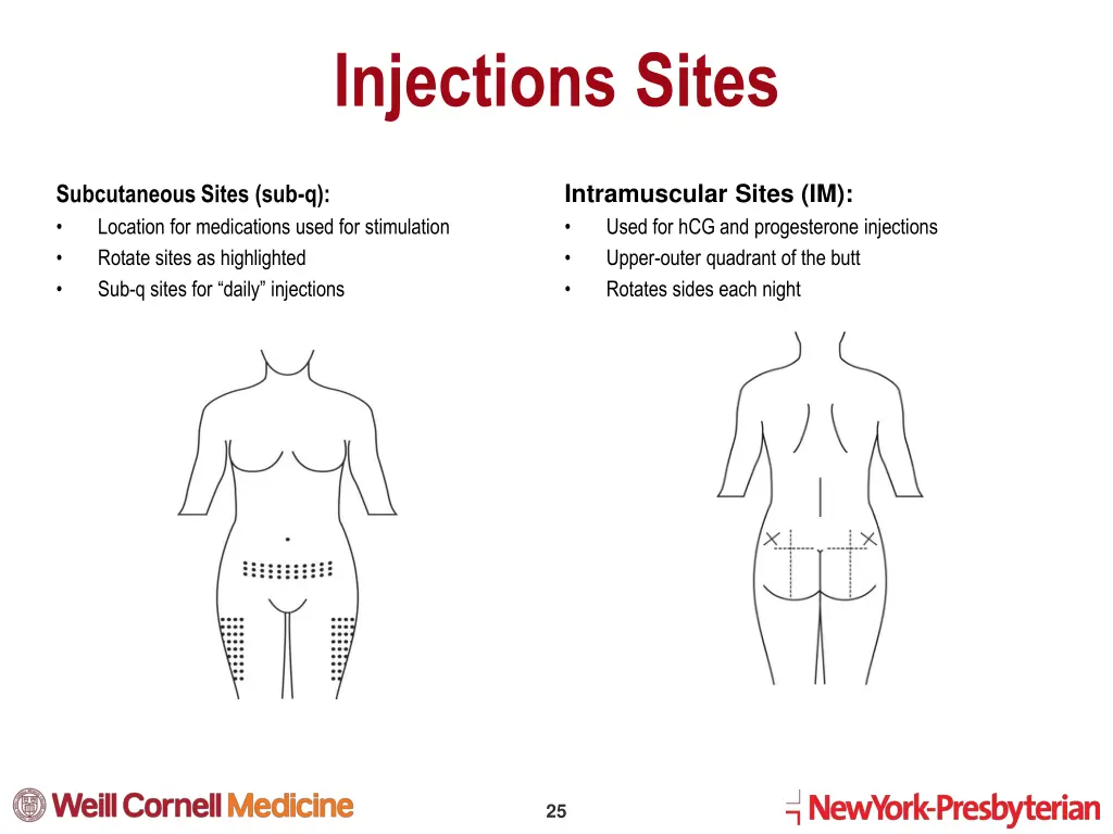 injections sites