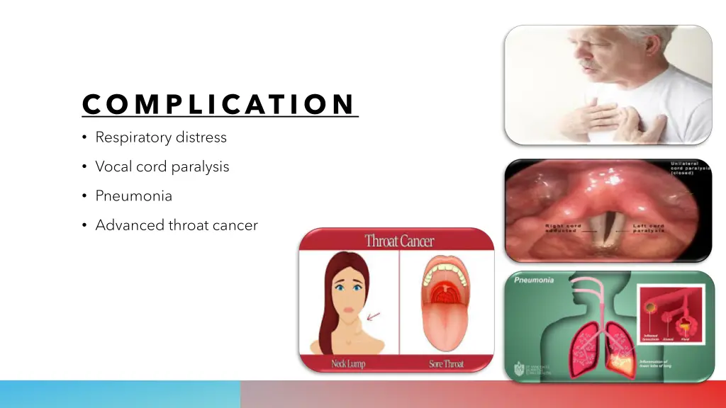 complication respiratory distress