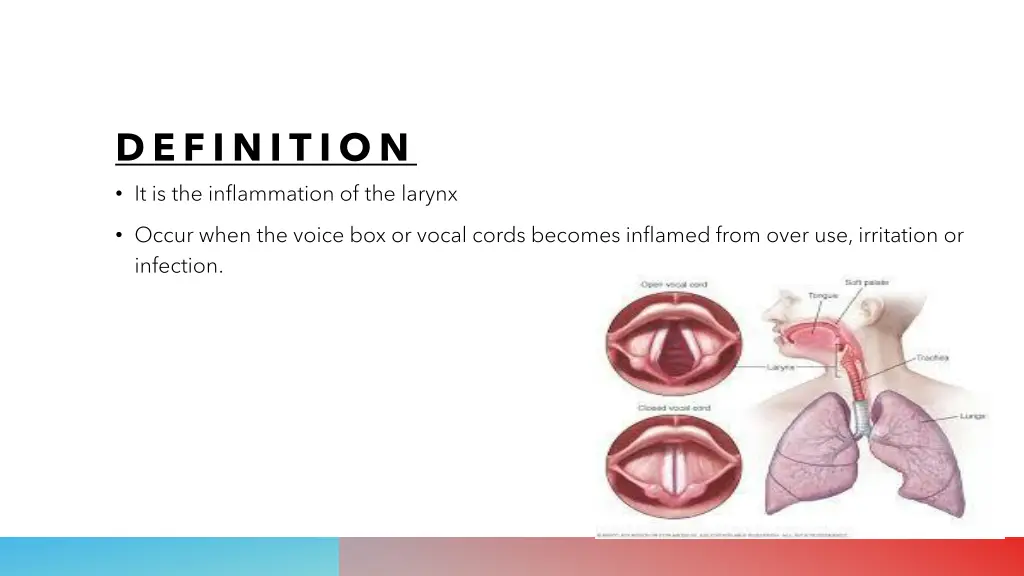 definition it is the inflammation of the larynx