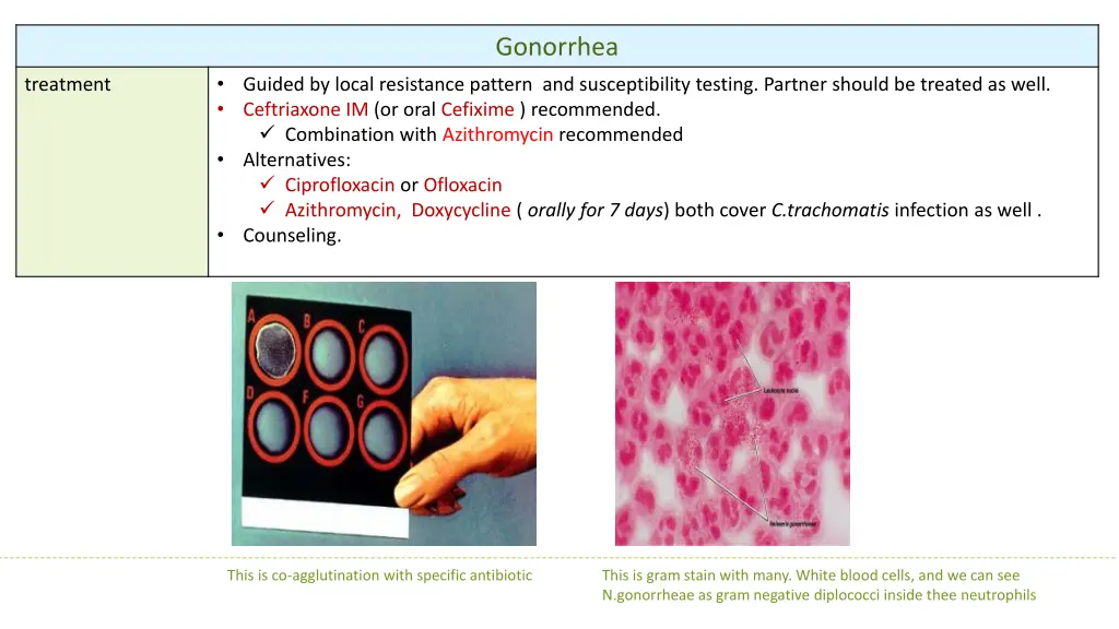 gonorrhea 1