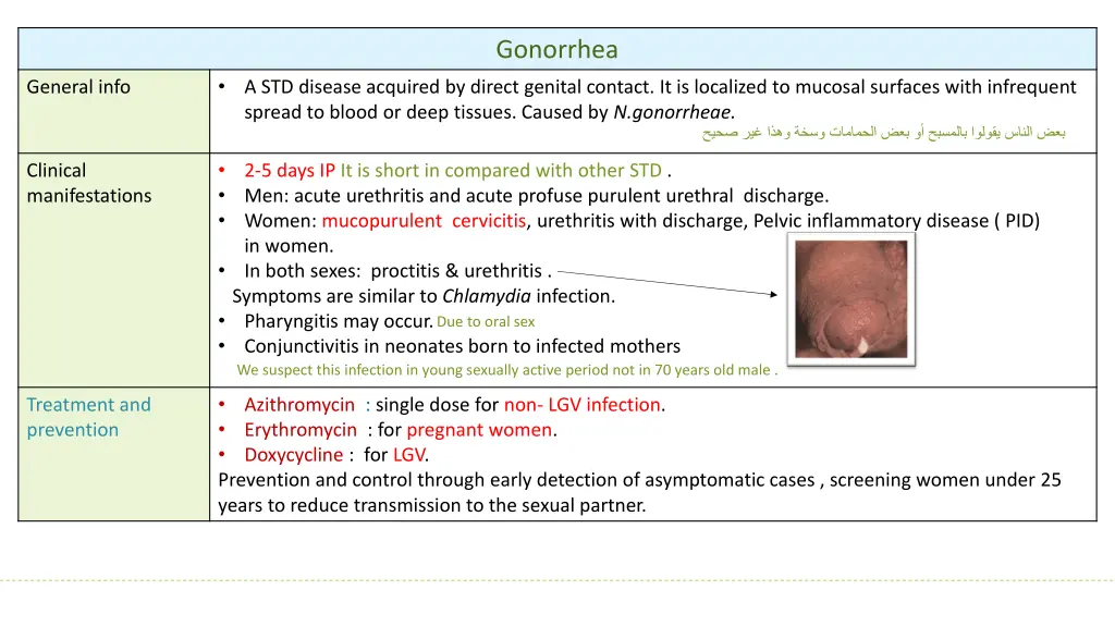 gonorrhea