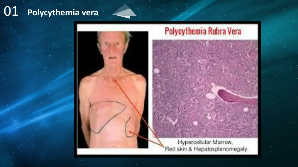 slide6