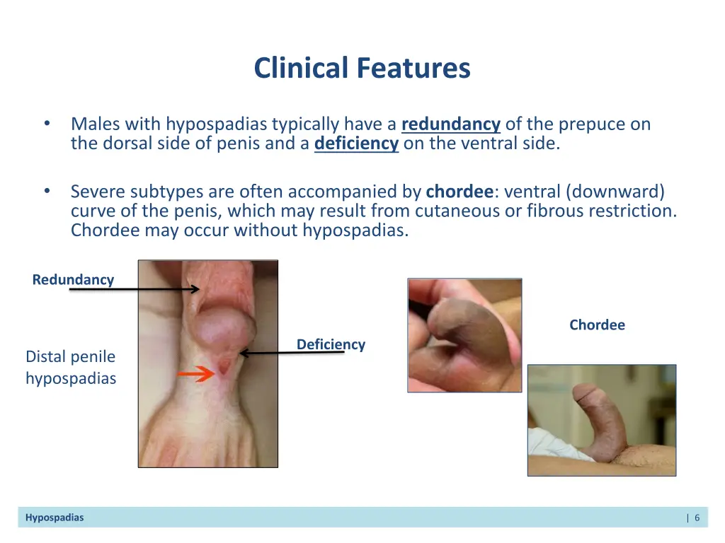 clinical features