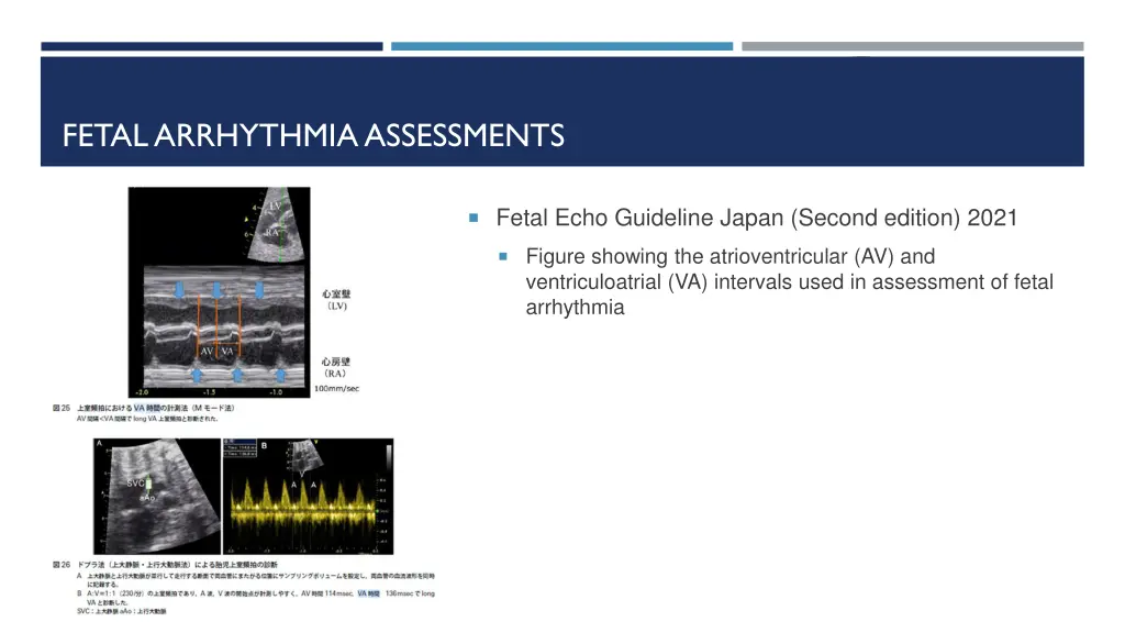 fetal arrhythmia assessments