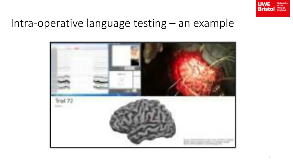 intra operative language testing an example