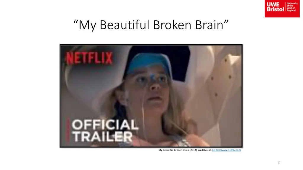 my beautiful broken brain