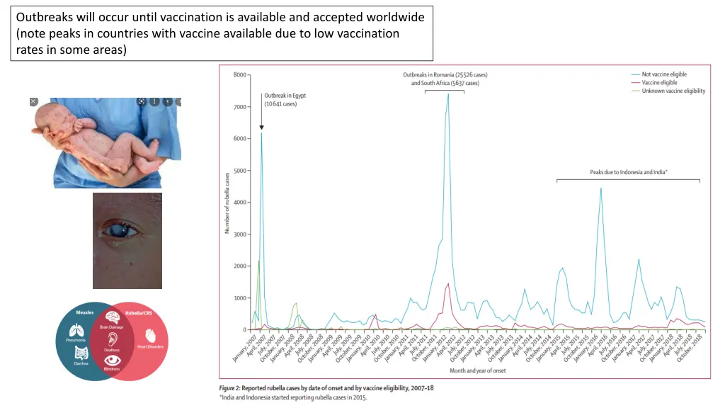 outbreaks will occur until vaccination