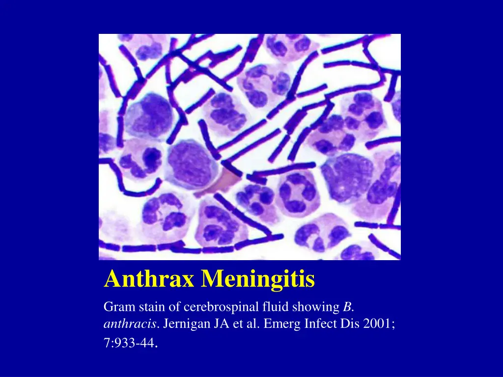 anthrax meningitis gram stain of cerebrospinal