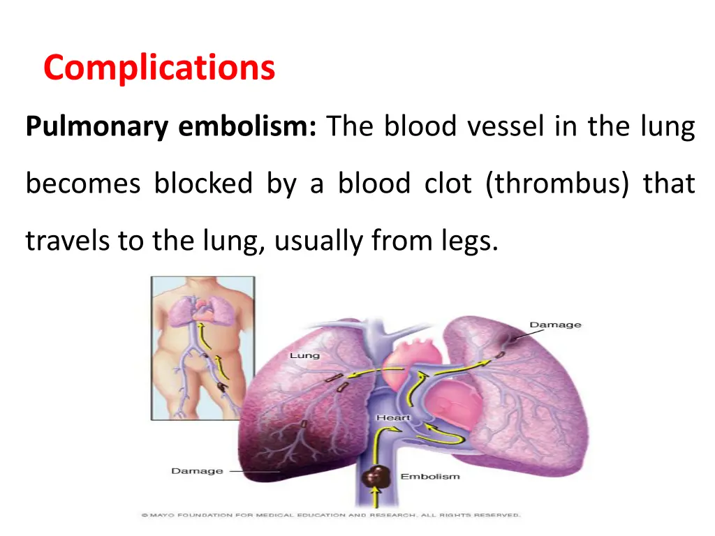complications