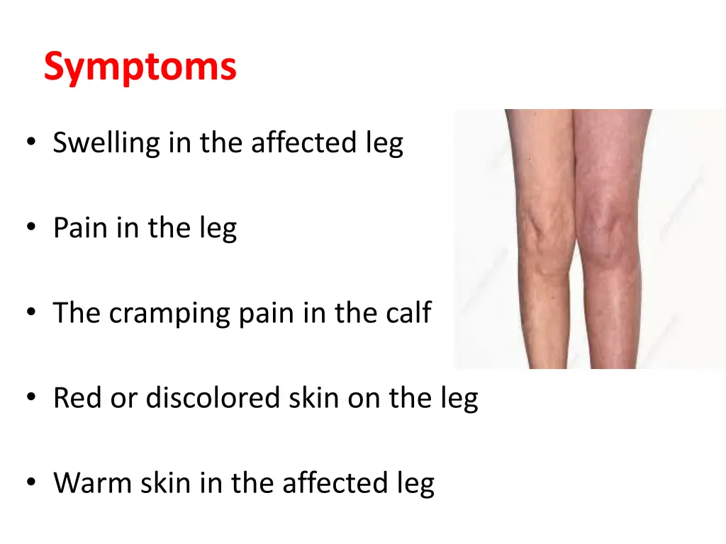 symptoms