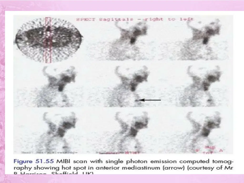 slide32