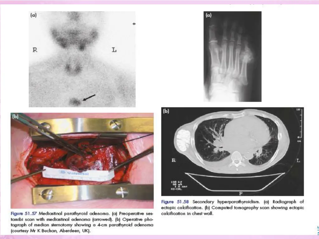 slide33