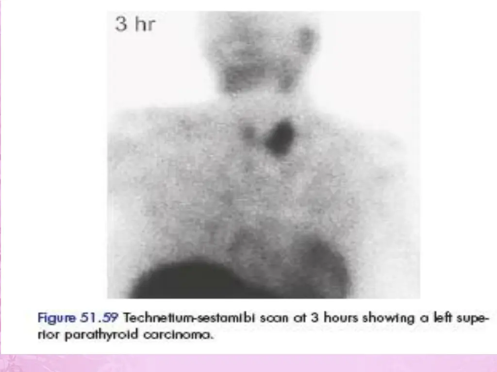slide34