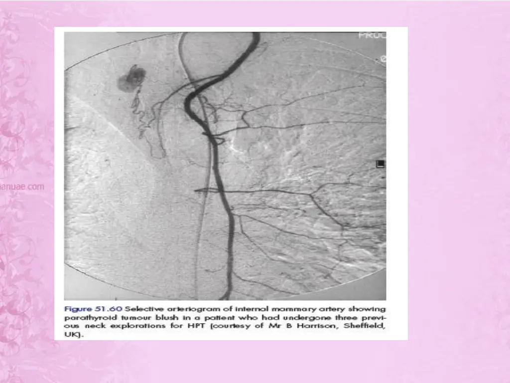slide35