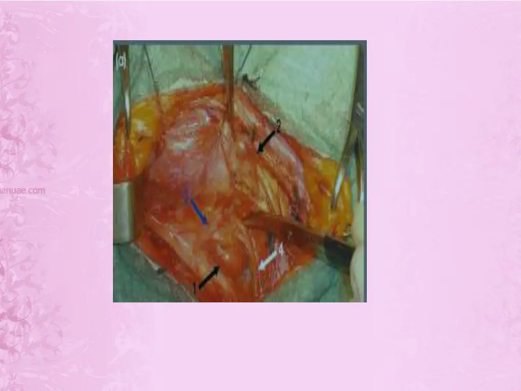 slide7