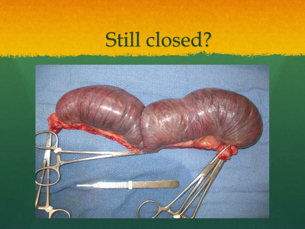 still closed