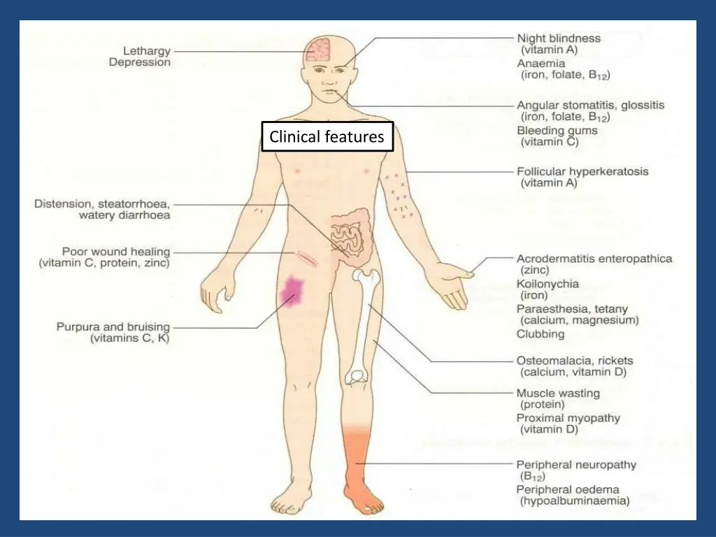 clinical features