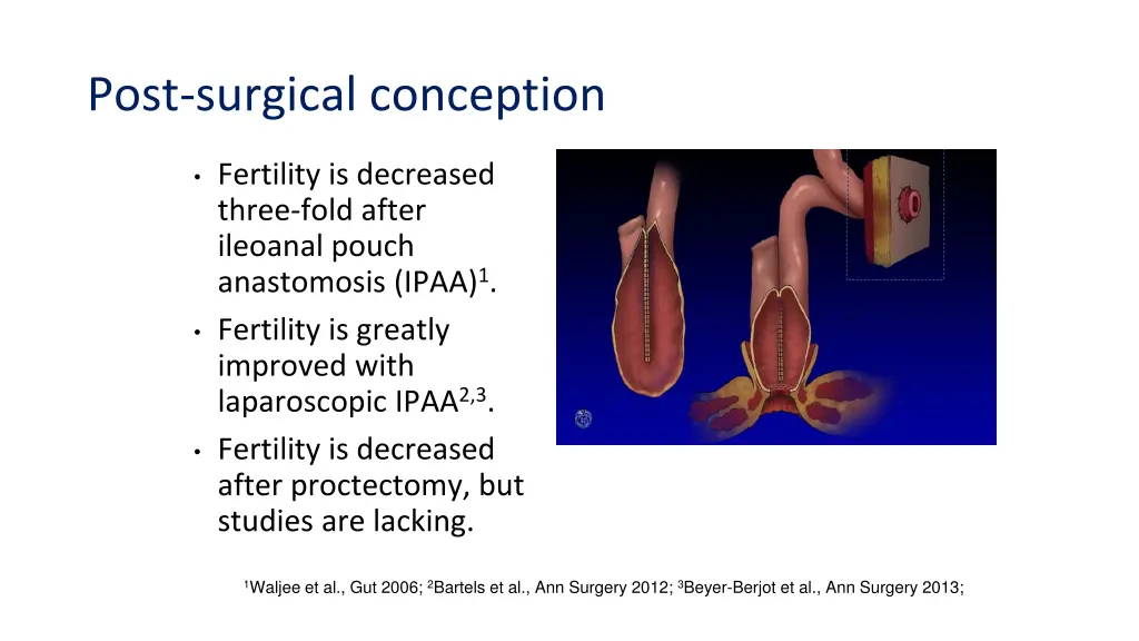 post surgical conception