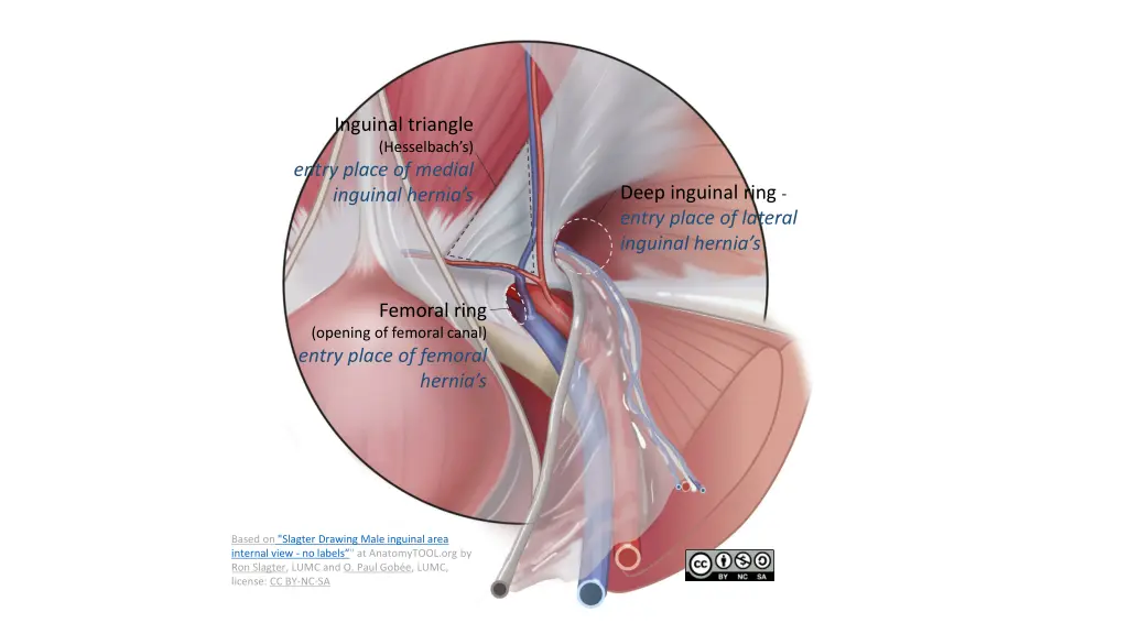 inguinal triangle hesselbach s entry place