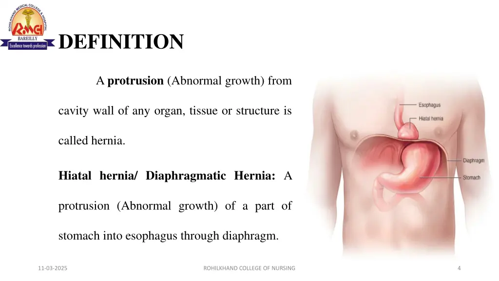 definition